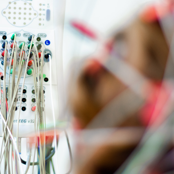 Fenster zum Gehirn: Was Epilepsie über neuronale Netzwerke, Schlaf und Gedächtnis verrät